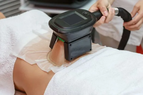 Image of person having fat freezing treatment to help weight gain Hucknall