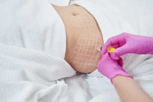 image of fat dissolving injections on love handles to help combat weight gain Hucknall