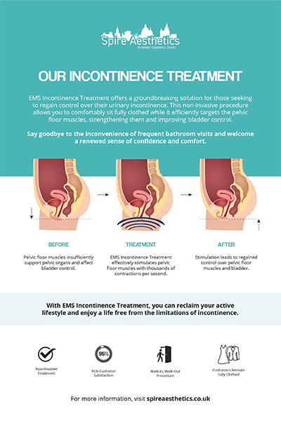 image of how urge incontinence Hucknall treatment works