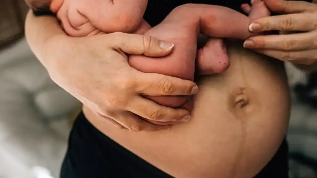 Why Is My Stomach Still Big After Pregnancy Hucknall?